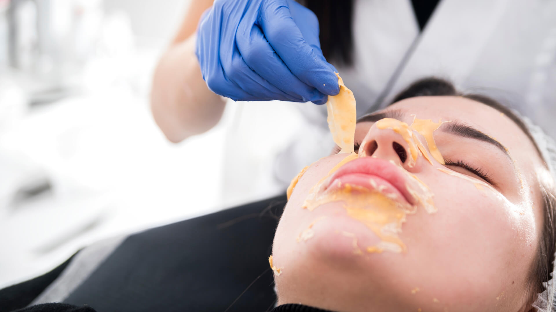 Ankara Çankaya Esmerlife Peeling Uygulamaları